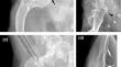 Synovial myxosarcoma in the scapulohumeral joint of a dog: a case report.