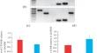 Interaction of pRb and β-Catenin in Cancer and Normal Human Prostate Tissue