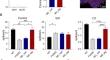 High Magnesium Promotes the Recovery of Binocular Vision from Amblyopia via TRPM7.