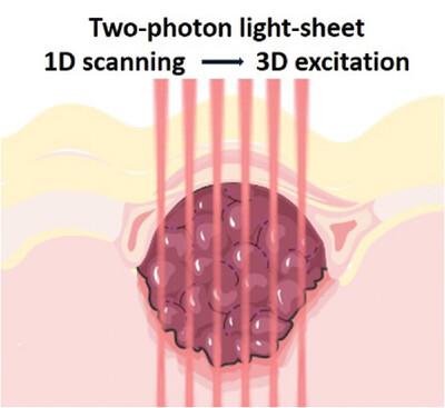 Highly Efficient Two-Photon Photodynamic Therapy Using Light-Sheet Excitation