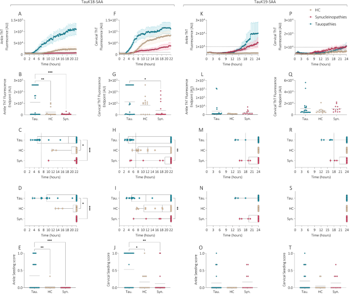 Tau seeding activity in skin biopsy differentiates tauopathies from synucleinopathies