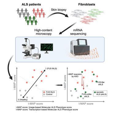 Identifying FUS amyotrophic lateral sclerosis disease signatures in patient dermal fibroblasts.