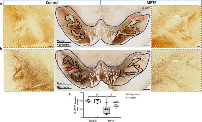 Neurovascular and immune factors of vulnerability of substantia nigra dopaminergic neurons in non-human primates