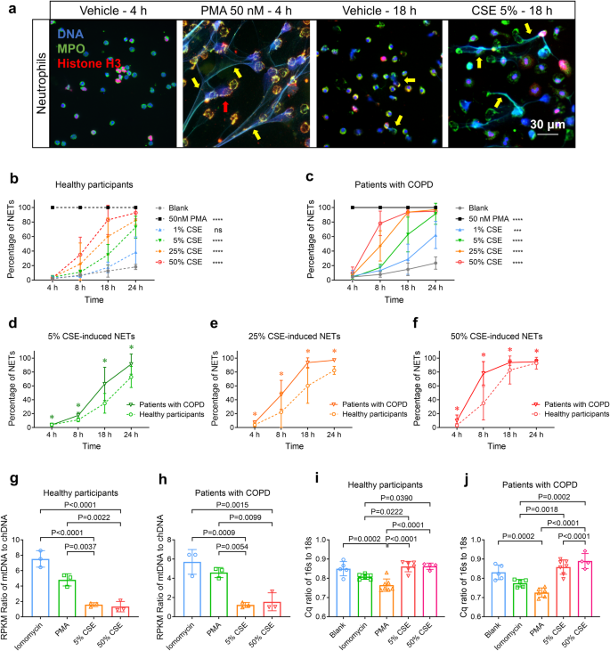 DNA of neutrophil extracellular traps promote NF-κB-dependent autoimmunity via cGAS/TLR9 in chronic obstructive pulmonary disease.