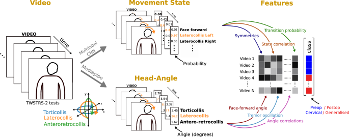 Head movement dynamics in dystonia: a multi-centre retrospective study using visual perceptive deep learning