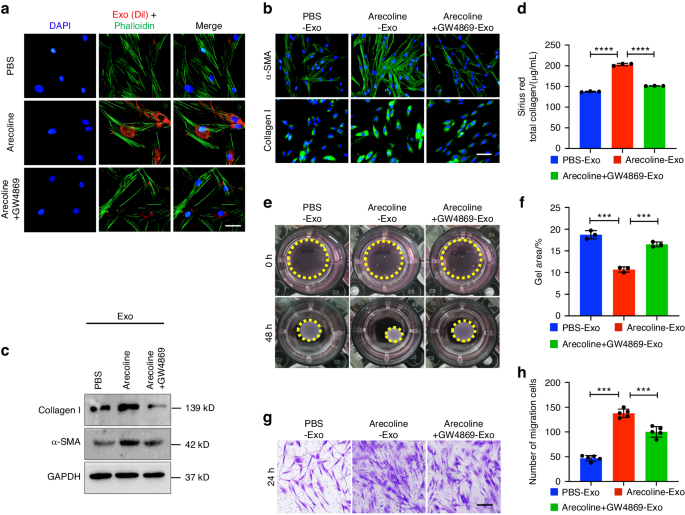 Exosomal miR-17-5p derived from epithelial cells is involved in aberrant epithelium-fibroblast crosstalk and induces the development of oral submucosal fibrosis.