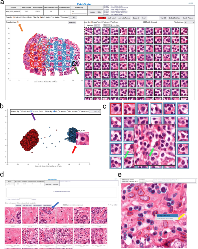 PatchSorter: a high throughput deep learning digital pathology tool for object labeling