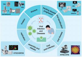 Application of advanced bioimaging technologies in viral infections