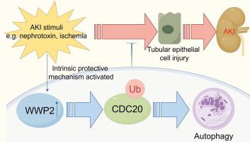 WWP2 deletion aggravates acute kidney injury by targeting CDC20/autophagy axis.