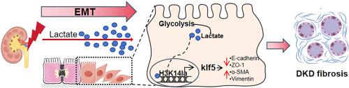 Lactate drives epithelial-mesenchymal transition in diabetic kidney disease via the H3K14la/KLF5 pathway