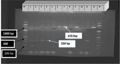 Detection of <i>Salmonella</i> and <i>Escherichia coli</i> along the Fish Value Chain in Bahir Dar City, Ethiopia.