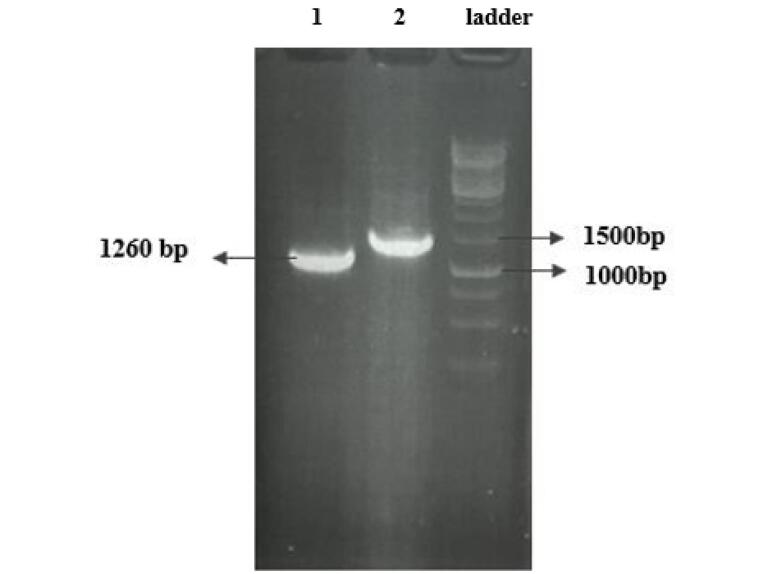 Performance of protein N linear epitopes in serodiagnosis of COVID-19 infection.