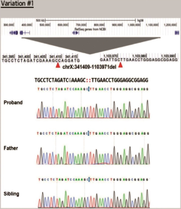 Identification of a novel mutation of the SHOX gene in a patient with Leri-Weill dyschondrosteosis accompanied by growth hormone deficiency.