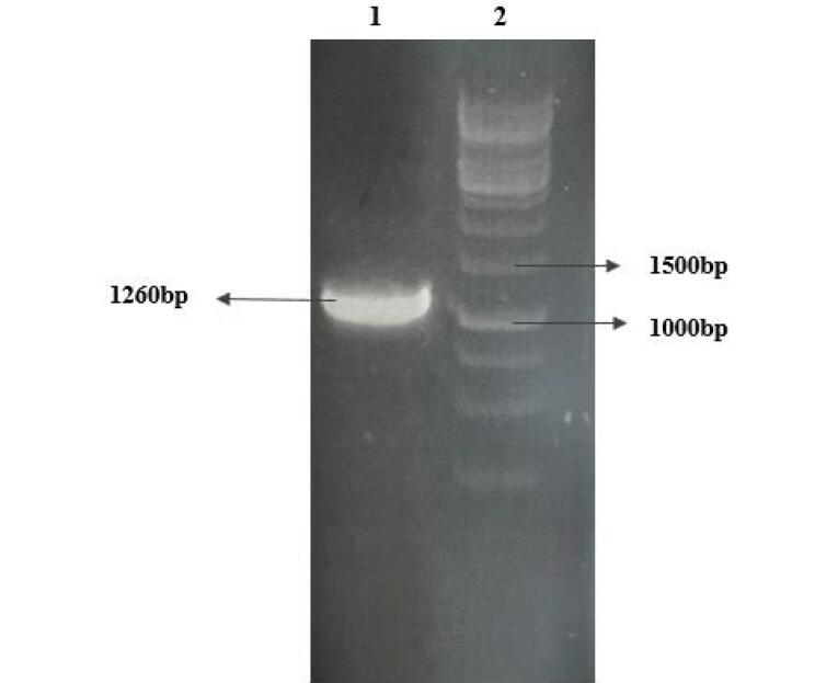 Performance of protein N linear epitopes in serodiagnosis of COVID-19 infection.