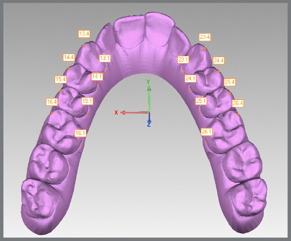Accuracy of arch expansion with two thermoplastic materials in Invisalign® patients: EX30® and SmartTrack®.