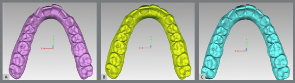 Accuracy of arch expansion with two thermoplastic materials in Invisalign® patients: EX30® and SmartTrack®.