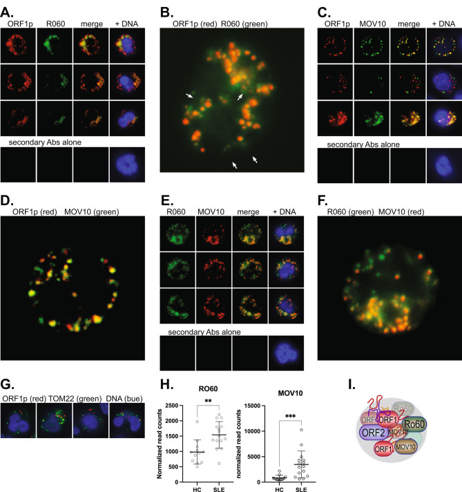Subcellular location of L1 retrotransposon-encoded ORF1p, reverse transcription products, and DNA sensors in lupus granulocytes.