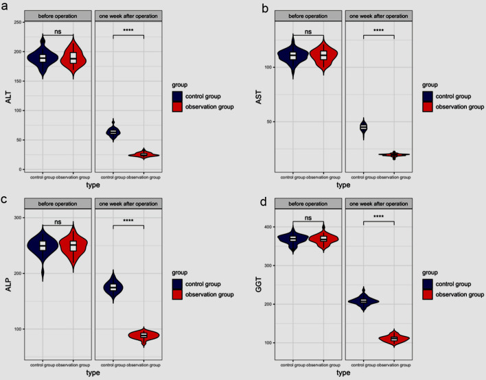 Analysis of Efficacy and Safety of Laparoscopy Plus Choledochoscopy Combined With Holmium Laser Lithotripsy for Choledocholithiasis and Hepatolithiasis.