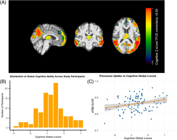 Early-phase amyloid PET reproduces metabolic signatures of cognitive decline in Parkinson's disease.