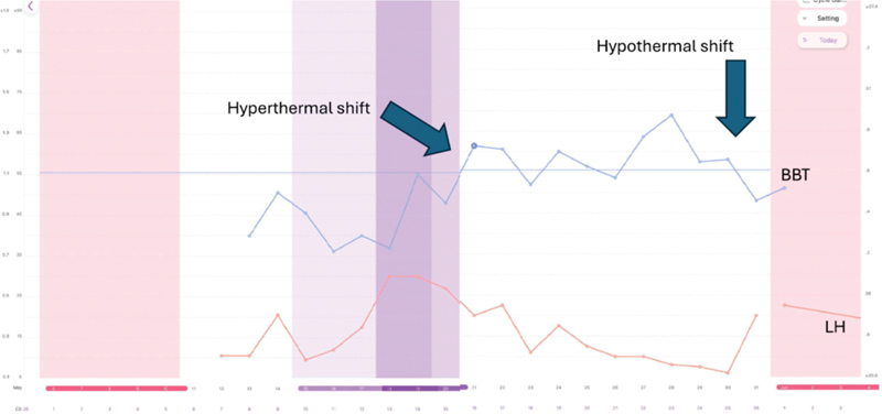 Helping Patients to Predict and Confirm Ovulation with the Use of Combined Urinary Hormonal and Smartphone Technology: A Proof-of-Concept Retrospective Descriptive Case Series.