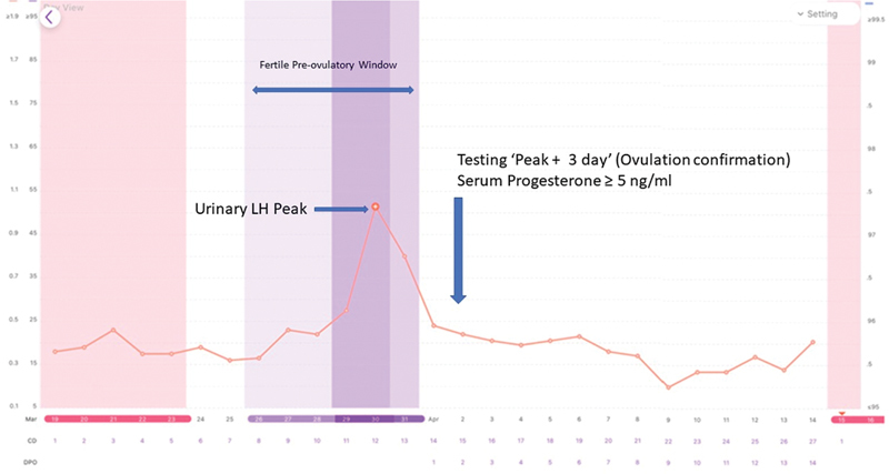 Helping Patients to Predict and Confirm Ovulation with the Use of Combined Urinary Hormonal and Smartphone Technology: A Proof-of-Concept Retrospective Descriptive Case Series.