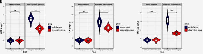 Analysis of Efficacy and Safety of Laparoscopy Plus Choledochoscopy Combined With Holmium Laser Lithotripsy for Choledocholithiasis and Hepatolithiasis.