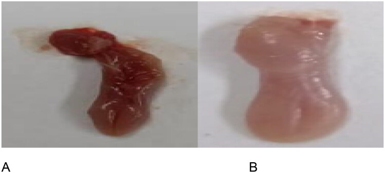 Antifungal Activity of 3-Hydrazinoquinoxaline-2-Thiol, a Novel Quinoxaline Derivative against Candida Species.
