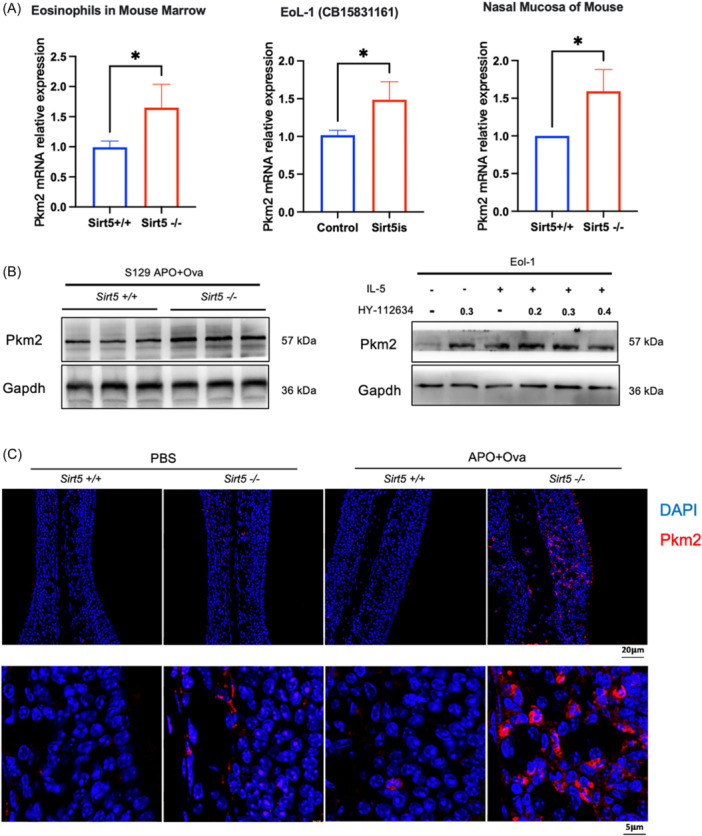 Sirt5 affects the metabolic remodeling of eosinophils by negatively regulating the level of succinylation modification of Pkm2 in eosinophilic chronic rhinosinusitis.