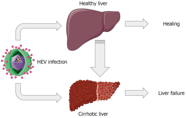 Pathogenesis and clinical features of severe hepatitis E virus infection.