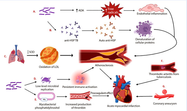 Coronary heart disease and tuberculosis: an unnoticed syndemia. Review of literature and management proposal.