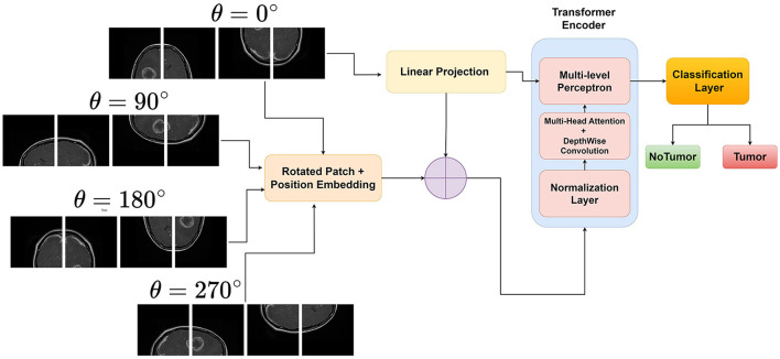 Enhancing brain tumor detection in MRI with a rotation invariant Vision Transformer.
