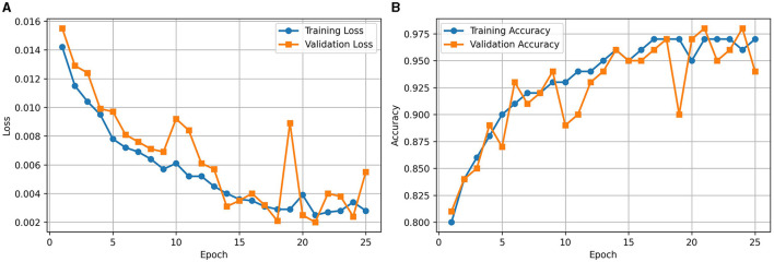 Enhancing brain tumor detection in MRI with a rotation invariant Vision Transformer.