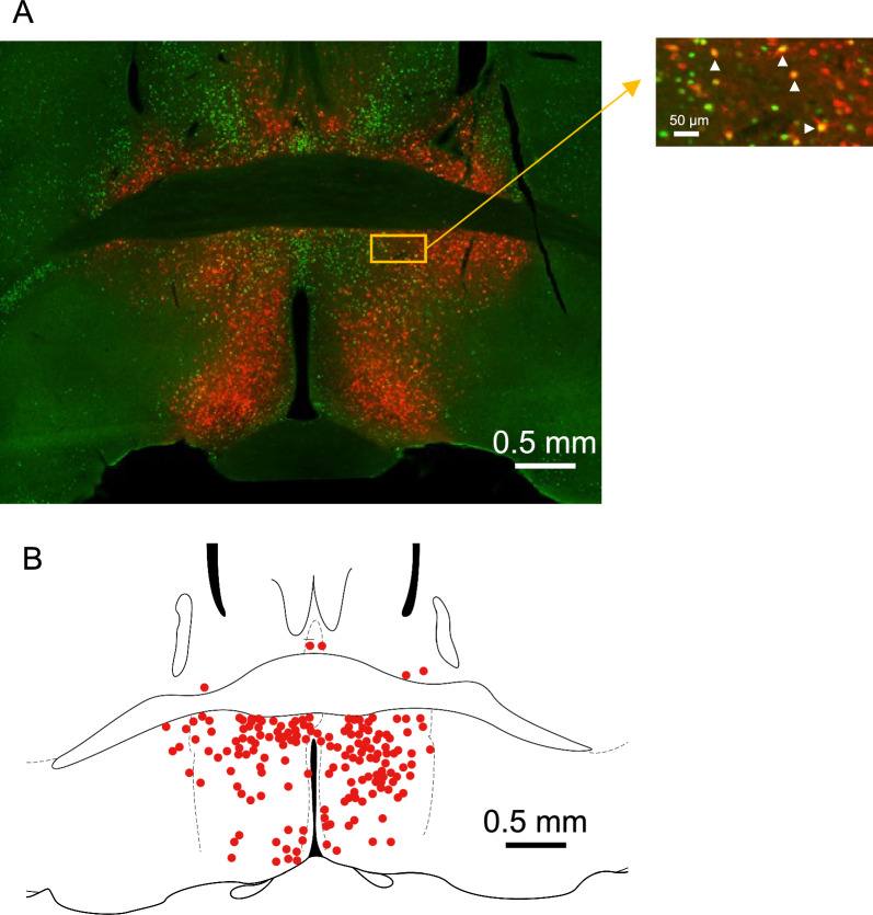 Identification of hypothermia-inducing neurons in the preoptic area and activation of them by isoflurane anesthesia and central injection of adenosine.