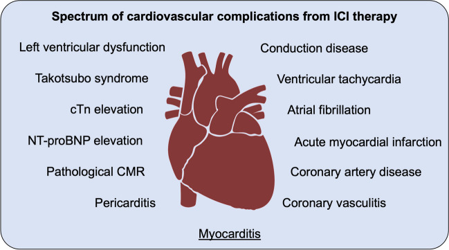 Cellular Alterations in Immune Checkpoint Inhibitor Therapy-Related Cardiac Dysfunction.