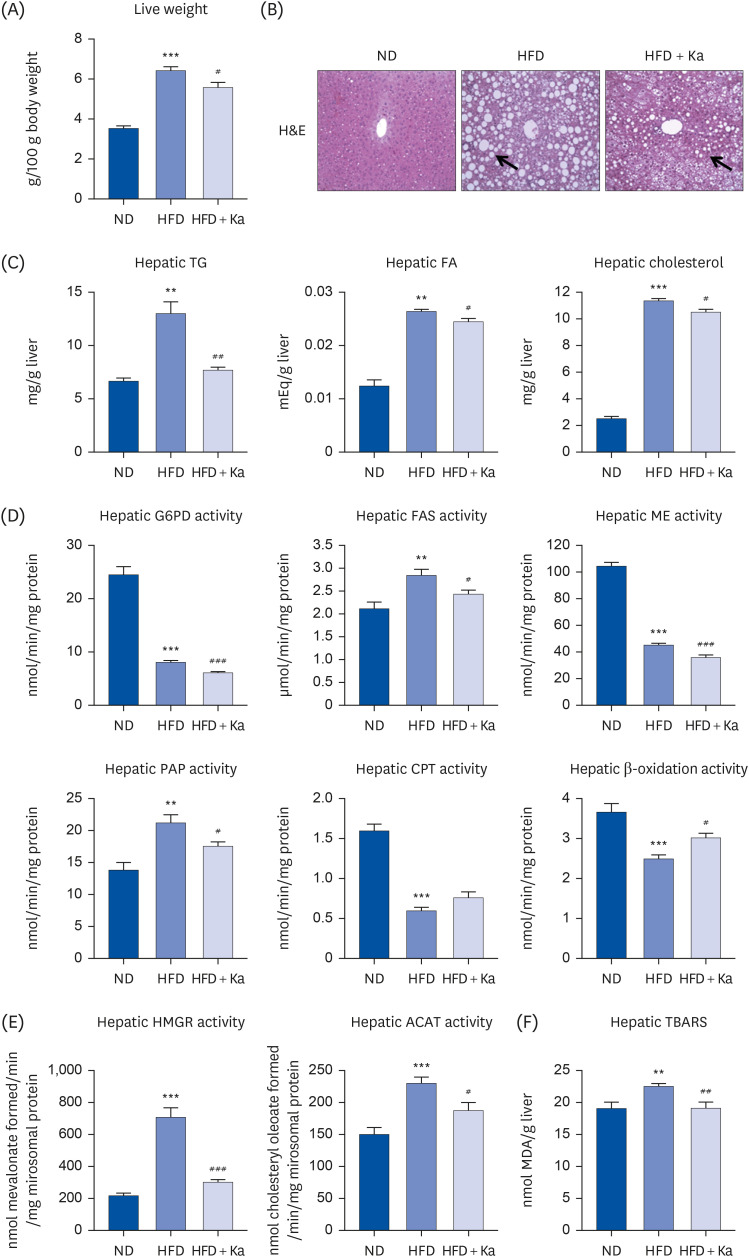 Kaempferol ameliorates metabolic syndrome by inhibiting inflammation and oxidative stress in high-fat diet-induced obese mice.
