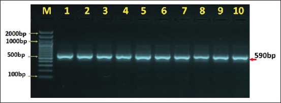 Molecular identification of <i>Entamoeba</i> spp. in humans and cattle in Baghdad, Iraq.