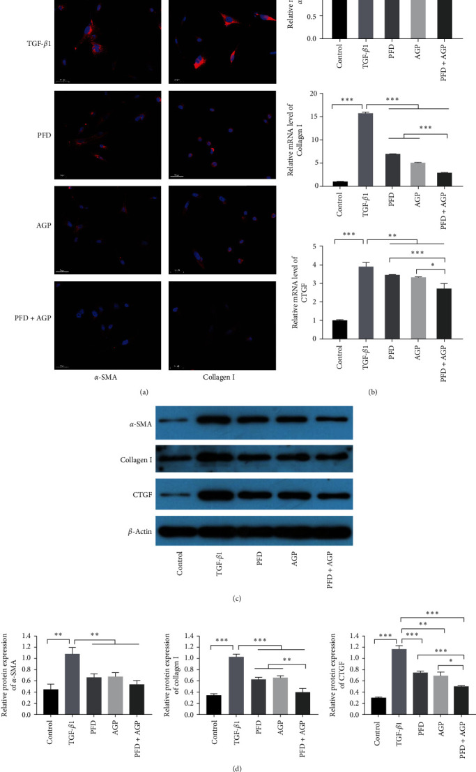 Combination of Pirfenidone and Andrographolide Ameliorates Hepatic Stellate Cell Activation and Liver Fibrosis by Mediating TGF-<i>β</i>/Smad Signaling Pathway.