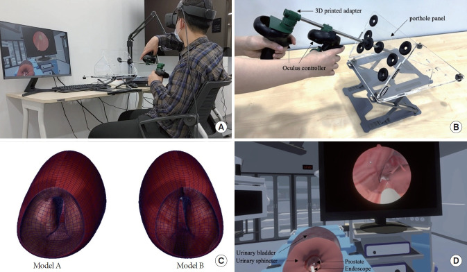 Effect of Self-Training Using Virtual Reality Head-Mounted Display Simulator on the Acquisition of Holmium Laser Enucleation of the Prostate Surgical Skills.