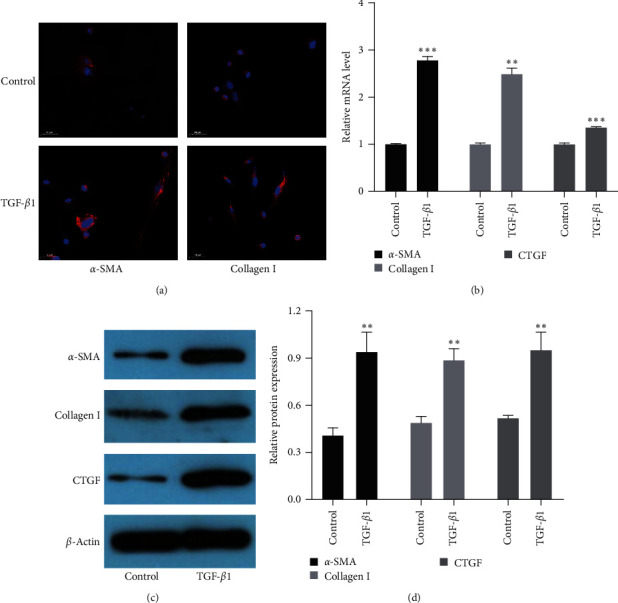 Combination of Pirfenidone and Andrographolide Ameliorates Hepatic Stellate Cell Activation and Liver Fibrosis by Mediating TGF-<i>β</i>/Smad Signaling Pathway.