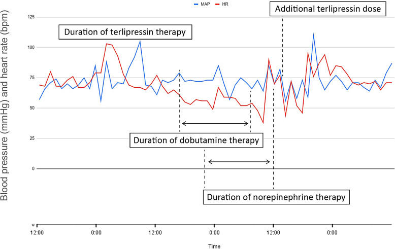 Severe Bradycardia Associated with the Use of Terlipressin: A Case Report.