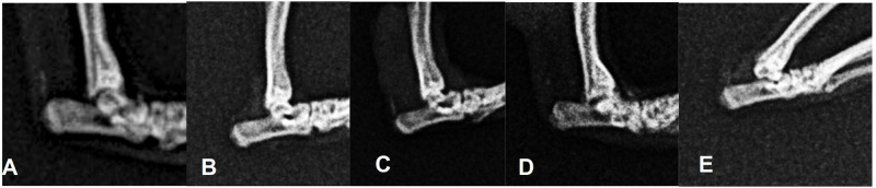 A Novel Diabetic Arthritic Model in Rats Induced by Streptozotocin, High-Fat Diet, and Complete Freund's Adjuvant.