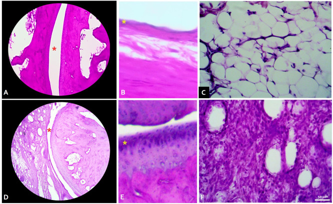 A Novel Diabetic Arthritic Model in Rats Induced by Streptozotocin, High-Fat Diet, and Complete Freund's Adjuvant.