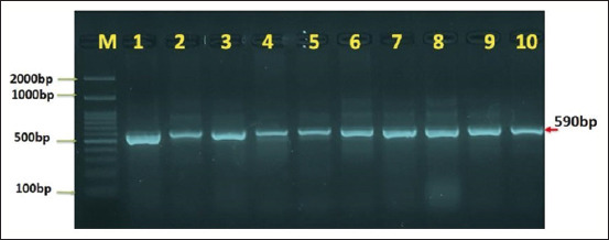 Molecular identification of <i>Entamoeba</i> spp. in humans and cattle in Baghdad, Iraq.