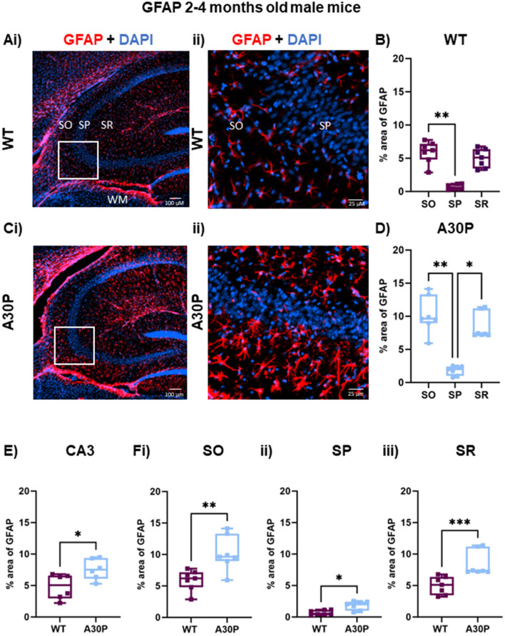 Evidence for prodromal changes in neuronal excitability and neuroinflammation in the hippocampus in young alpha-synuclein (A30P) transgenic mice.