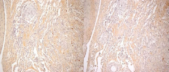 Effects of pioglitazone and metformin on abdominal adhesion formation in an experimental model.