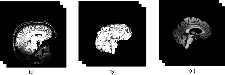 Brain age gap estimation using attention-based ResNet method for Alzheimer's disease detection.
