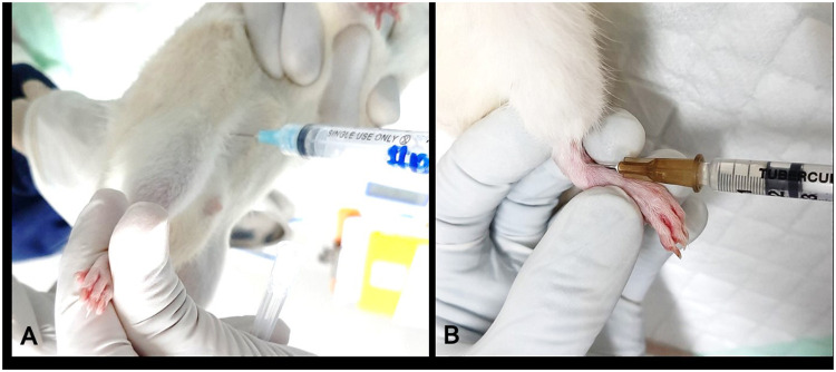 A Novel Diabetic Arthritic Model in Rats Induced by Streptozotocin, High-Fat Diet, and Complete Freund's Adjuvant.
