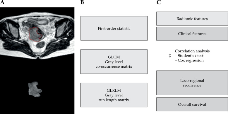 Pre-treatment T2-weighted magnetic resonance radiomics for prediction of loco-regional recurrence after image-guided adaptive brachytherapy for locally advanced cervical cancer.