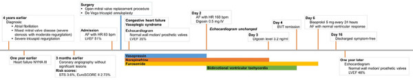 Bidirectional ventricular tachycardia due to digoxin-diuretic interaction in post-cardiac surgery patient: a case report.