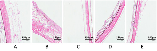 Effects of artificial light with different spectral compositions on refractive development and matrix metalloproteinase 2 and tissue inhibitor of metalloproteinases 2 expression in the sclerae of juvenile guinea pigs.